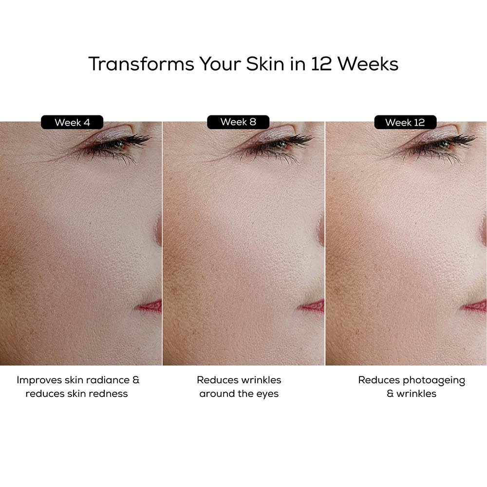 6 - TrueBasics Collagen Skin 15 units Collagen Flavour + Vitamin C Serum Combo,  30 ml  Unflavoured
